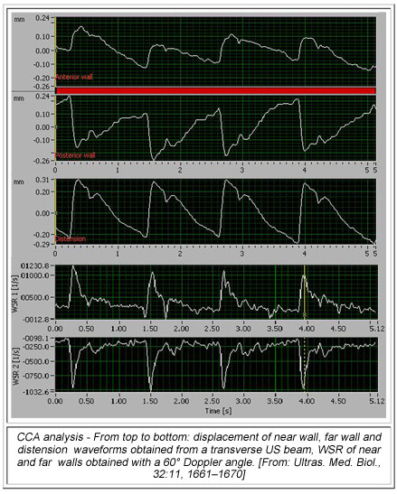 02_cca-analysis.jpg